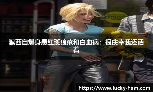 Ng28娱乐：猴西自爆身患红斑狼疮和白血病：很庆幸我还活着
